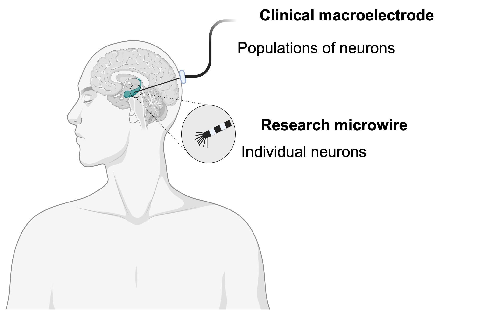 Flexibility supported across brain regions